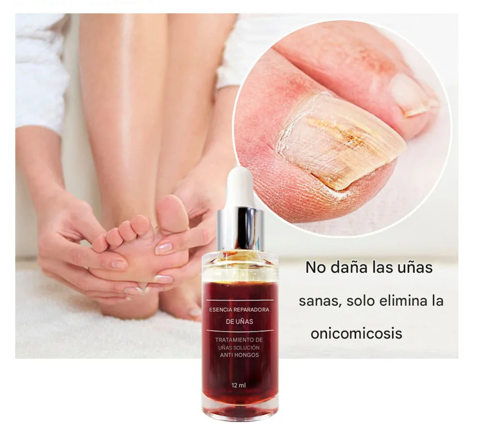 LANBENA™ | Serum Repara Uñas -Antihongos fórmula antifúngica
