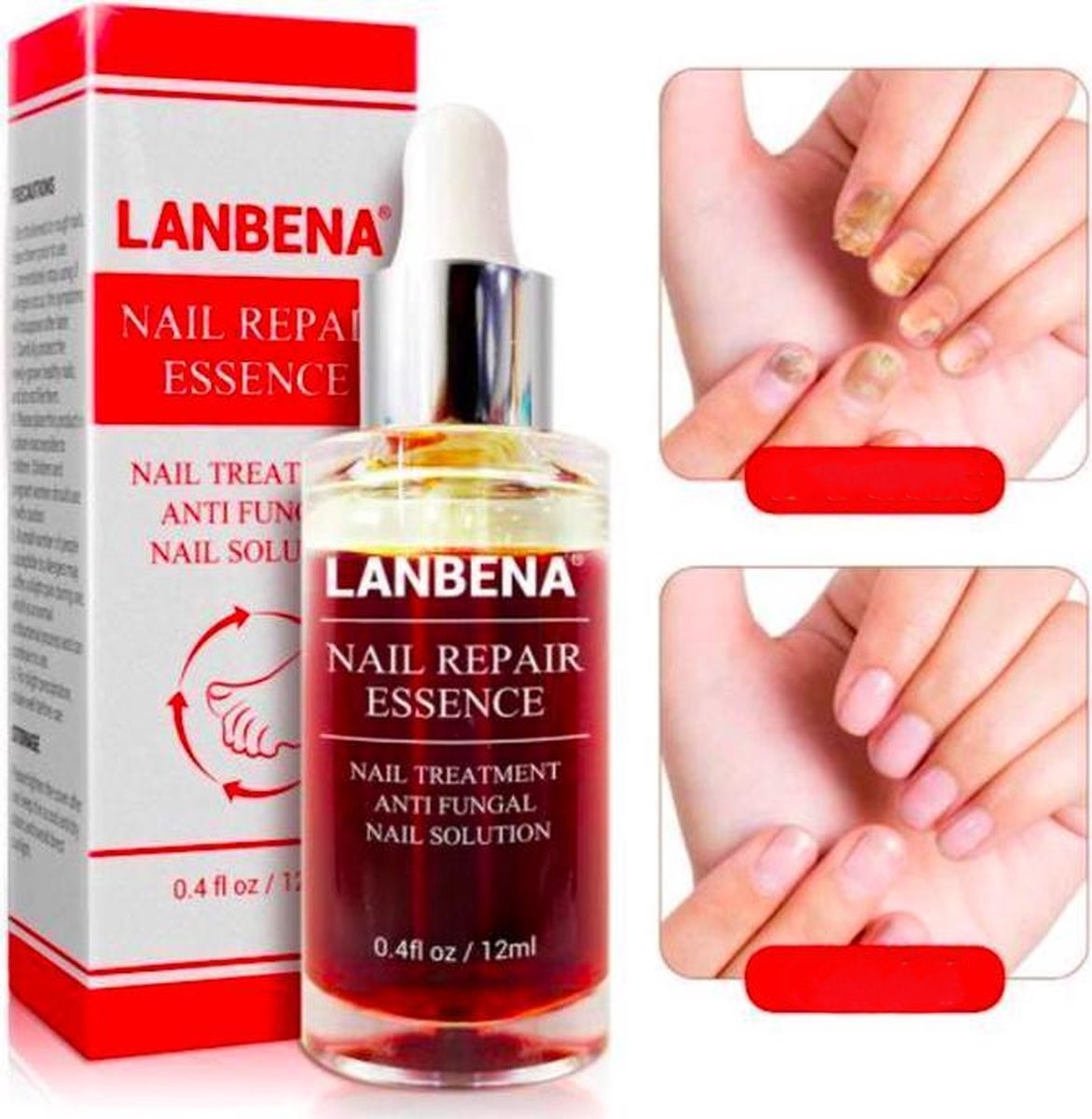 LANBENA™ | Serum Repara Uñas -Antihongos fórmula antifúngica
