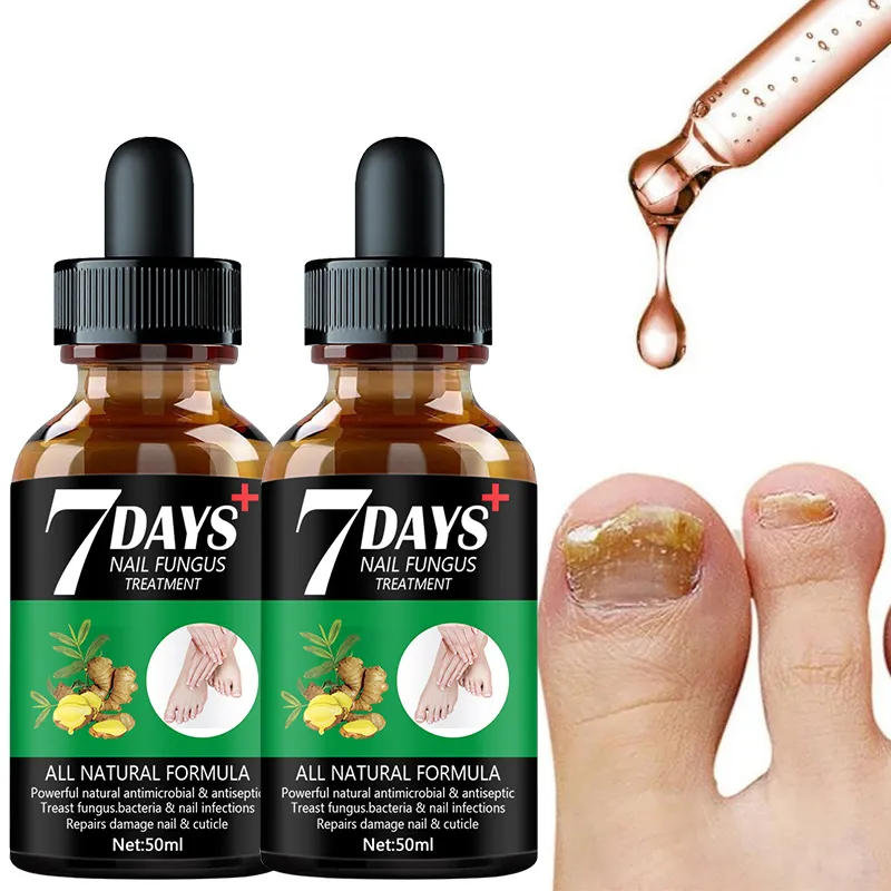 Fungus Free Nails® |  ¡No ignores el problema! Recupera la salud y belleza de tus uñas !