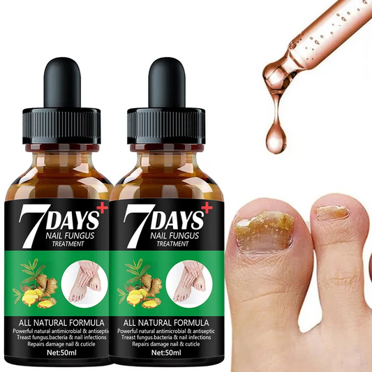 Fungus Free Nails® |  ¡No ignores el problema! Recupera la salud y belleza de tus uñas !