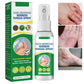 2x1  FreshSpray® |  Spray Antihongos para Pies y Manos + Envío Gratis