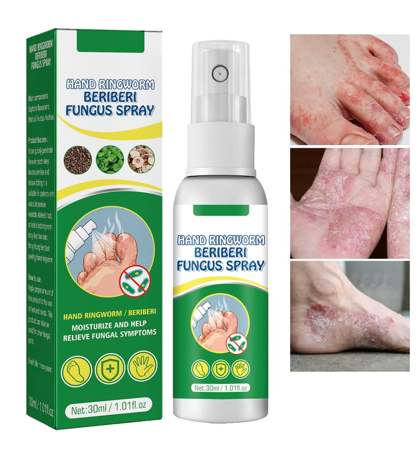 2x1  FreshSpray® |  Spray Antihongos para Pies y Manos + Envío Gratis