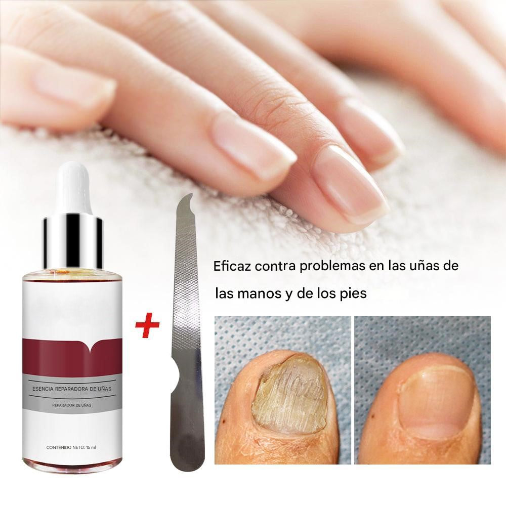 LANBENA™ | Serum Repara Uñas -Antihongos fórmula antifúngica