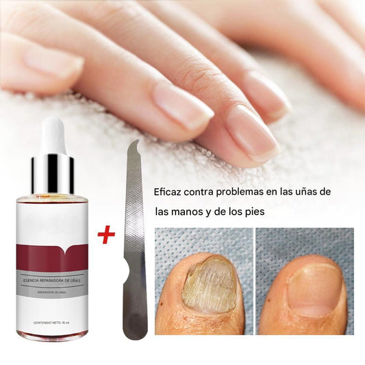 LANBENA™ | Serum Repara Uñas -Antihongos fórmula antifúngica