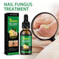 Fungus Free Nails® |  ¡No ignores el problema! Recupera la salud y belleza de tus uñas !