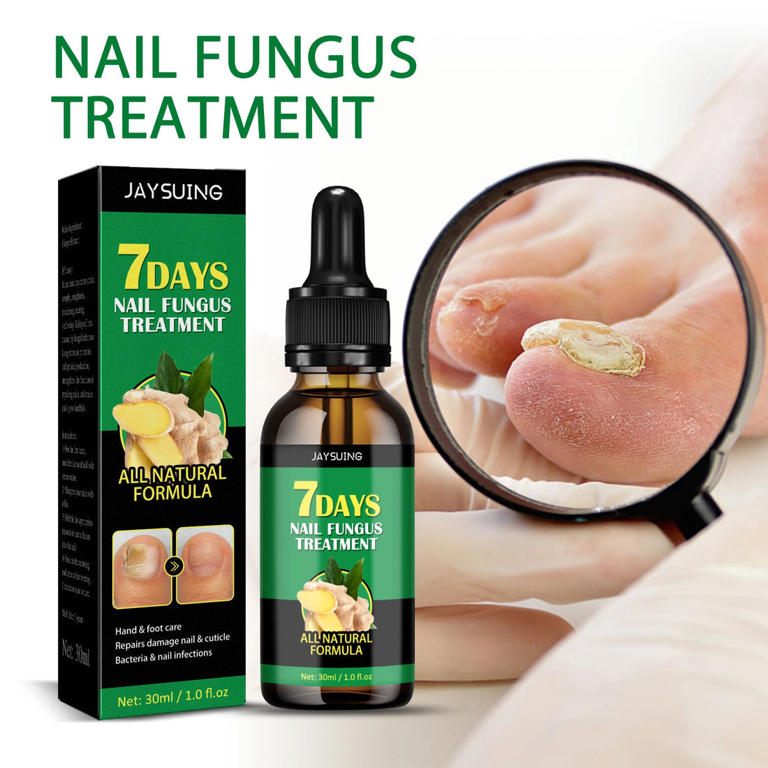 Fungus Free Nails® |  ¡No ignores el problema! Recupera la salud y belleza de tus uñas !