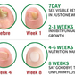 Fungus Free Nails® |  ¡No ignores el problema! Recupera la salud y belleza de tus uñas !