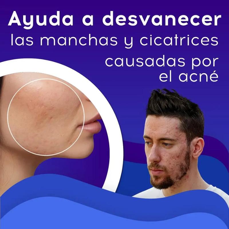 Bioaqua® | 2x1 Crema AntiAcné & Reparadora de Cicatrices de Acné