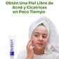 Bioaqua® | 2x1 Crema AntiAcné & Reparadora de Cicatrices de Acné