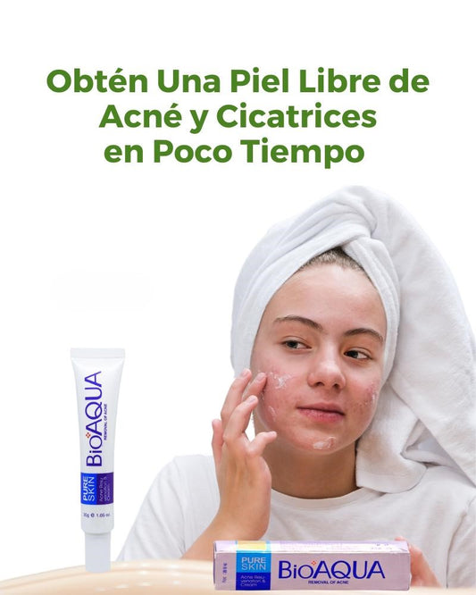 Bioaqua® | 2x1 Crema AntiAcné & Reparadora de Cicatrices de Acné