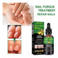 Fungus Free Nails® |  ¡No ignores el problema! Recupera la salud y belleza de tus uñas !