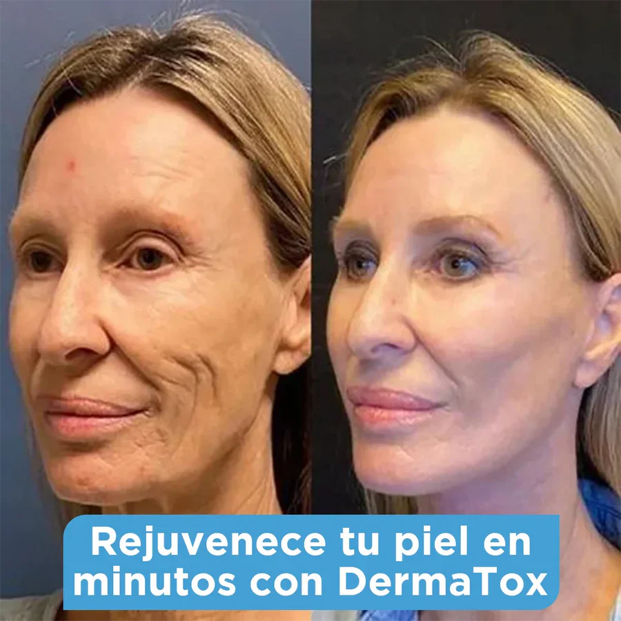 Serum Antiedad DermaTox™ | El serum que borra los años sin tocar con una aguja