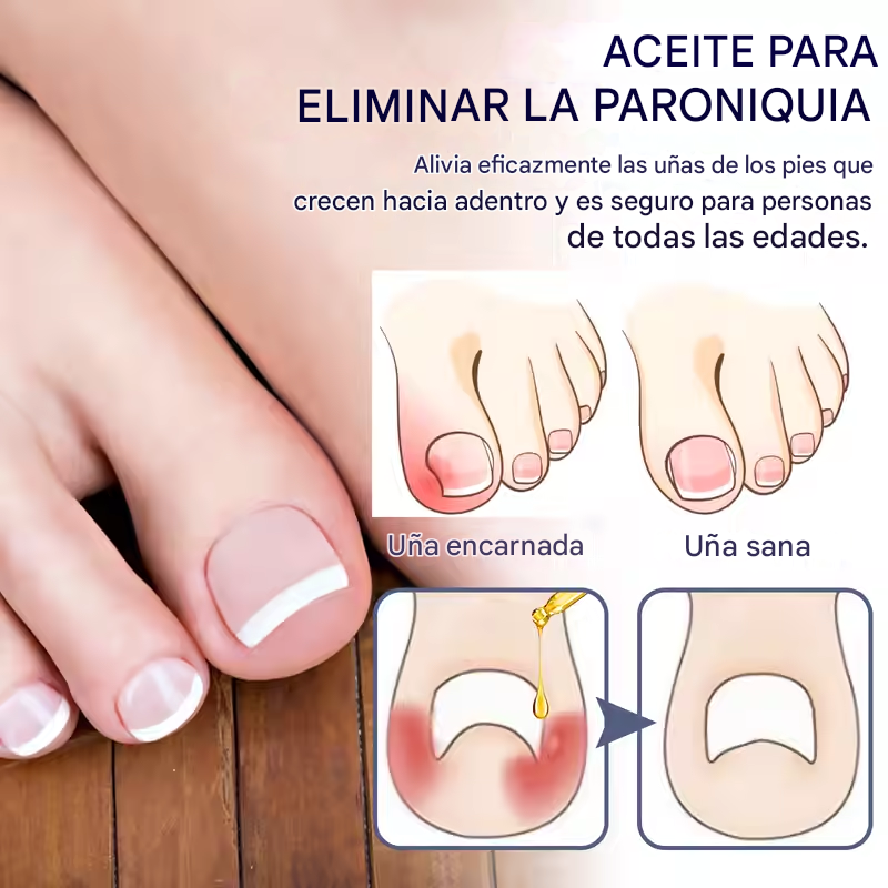 West&Month™ | Serum Reparador Uñas