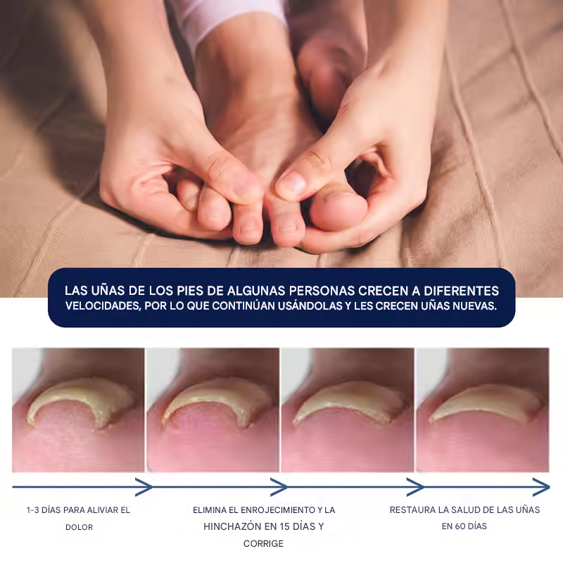 West&Month™ | Serum Reparador Uñas