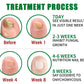 Fungus Free Nails® |  ¡No ignores el problema! Recupera la salud y belleza de tus uñas !