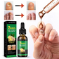 Fungus Free Nails® |  ¡No ignores el problema! Recupera la salud y belleza de tus uñas !
