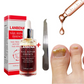 LANBENA™ | Serum Repara Uñas -Antihongos fórmula antifúngica