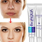 Bioaqua® | 2x1 Crema AntiAcné & Reparadora de Cicatrices de Acné