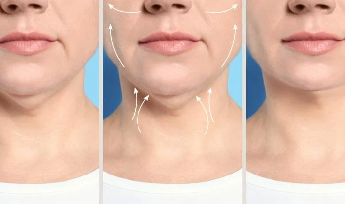 MASAJEADOR FACIAL FACELIFT ®- ELIMINA PAPADAS Y ARRUGAS