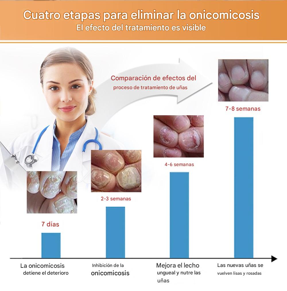 LANBENA™ | Serum Repara Uñas -Antihongos fórmula antifúngica