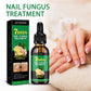 Fungus Free Nails® |  ¡No ignores el problema! Recupera la salud y belleza de tus uñas !